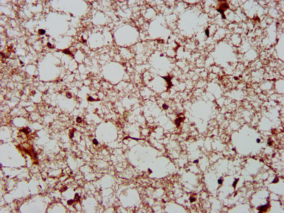 Immunofluorescence staining of A549 cells with CAC11405 at 1:133, counter-stained with DAPI. The cells were fixed in 4% formaldehyde, permeabilized using 0.2% Triton X-100 and blocked in 10% normal Goat Serum. The cells were then incubated with the antibody overnight at 4°C. The secondary antibody was Alexa Fluor 488-congugated AffiniPure Goat Anti-Rabbit IgG(H+L).