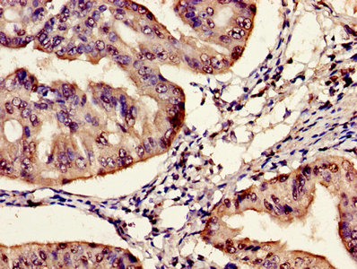Immunofluorescent analysis of MCF-7 cells using CAC11407 at dilution of 1:100 and Alexa Fluor 488-congugated AffiniPure Goat Anti-Rabbit IgG(H+L)