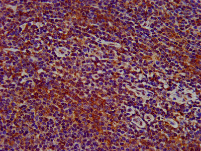 IHC image diluted at 1:400 and staining in paraffin-embedded human spleen tissue performed on a Leica BondTM system. After dewaxing and hydration, antigen retrieval was mediated by high pressure in a citrate buffer (pH 6.0). Section was blocked with 10% normal goat serum 30min at RT. Then primary antibody (1% BSA) was incubated at 4°C overnight. The primary is detected by a biotinylated secondary antibody and visualized using an HRP conjugated SP system.