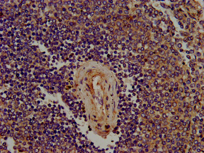 Immunofluorescence staining of Hela cells with CAC11409 at 1:133, counter-stained with DAPI. The cells were fixed in 4% formaldehyde, permeabilized using 0.2% Triton X-100 and blocked in 10% normal Goat Serum. The cells were then incubated with the antibody overnight at 4°C. The secondary antibody was Alexa Fluor 488-congugated AffiniPure Goat Anti-Rabbit IgG(H+L).