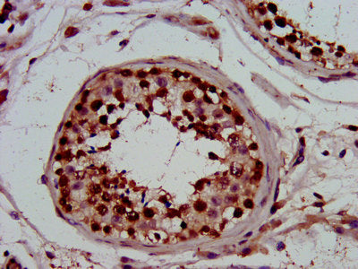 Immunofluorescence staining of HepG2 cells with CAC11415 at 1:266, counter-stained with DAPI. The cells were fixed in 4% formaldehyde, permeabilized using 0.2% Triton X-100 and blocked in 10% normal Goat Serum. The cells were then incubated with the antibody overnight at 4°C. The secondary antibody was Alexa Fluor 488-congugated AffiniPure Goat Anti-Rabbit IgG(H+L).