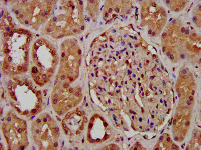 IHC image diluted at 1:400 and staining in paraffin-embedded human brain tissue performed on a Leica BondTM system. After dewaxing and hydration, antigen retrieval was mediated by high pressure in a citrate buffer (pH 6.0). Section was blocked with 10% normal goat serum 30min at RT. Then primary antibody (1% BSA) was incubated at 4°C overnight. The primary is detected by a biotinylated secondary antibody and visualized using an HRP conjugated SP system.