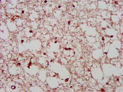 Immunofluorescence staining of Hela cells with CAC11417 at 1:133, counter-stained with DAPI. The cells were fixed in 4% formaldehyde, permeabilized using 0.2% Triton X-100 and blocked in 10% normal Goat Serum. The cells were then incubated with the antibody overnight at 4°C. The secondary antibody was Alexa Fluor 488-congugated AffiniPure Goat Anti-Rabbit IgG(H+L).