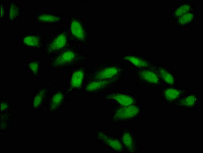 Pcgf1 Polyclonal Antibody - image 4