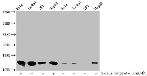 Immunofluorescence staining of Hela cells (treated with 30mM sodium butyrate for 4h) with CAC11431 at 1:37.5, counter-stained with DAPI. The cells were fixed in 4% formaldehyde, permeabilized using 0.2% Triton X-100 and blocked in 10% normal Goat Serum. The cells were then incubated with the antibody overnight at 4°C. The secondary antibody was Alexa Fluor 488-congugated AffiniPure Goat Anti-Rabbit IgG(H+L).