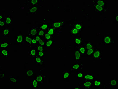 Immunocytochemistry analysis diluted at 1:75 and staining in Hela cells (treated with 30mM sodium butyrate for 4h) performed on a Leica BondTM system. The cells were fixed in 4% formaldehyde, permeabilized using 0.2% Triton X-100 and blocked with 10% normal goat serum 30min at RT. Then primary antibody (1% BSA) was incubated at 4°C overnight. The primary is detected by a biotinylated secondary antibody and visualized using an HRP conjugated SP system.
