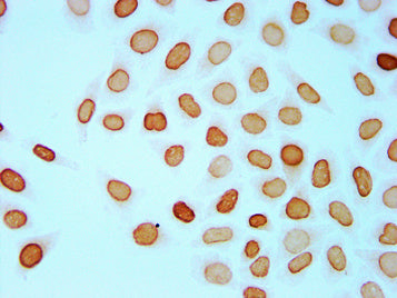Chromatin Immunoprecipitation Hela (4*106, treated with 30mM sodium butyrate for 4h) were treated with Micrococcal Nuclease, sonicated, and immunoprecipitated with 5µg anti-HIST1H4A (CAC11431) or a control normal rabbit IgG. The resulting ChIP DNA was quantified using real-time PCR with primers against the ß-Globin promoter.
