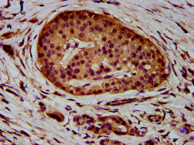 Immunofluorescence staining of 293 cells with CAC11433 at 1:133, counter-stained with DAPI. The cells were fixed in 4% formaldehyde, permeabilized using 0.2% Triton X-100 and blocked in 10% normal Goat Serum. The cells were then incubated with the antibody overnight at 4°C. The secondary antibody was Alexa Fluor 488-congugated AffiniPure Goat Anti-Rabbit IgG(H+L).