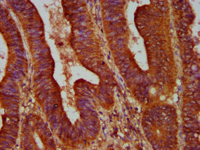 IHC image diluted at 1:500 and staining in paraffin-embedded human skeletal muscle tissue performed on a Leica BondTM system. After dewaxing and hydration, antigen retrieval was mediated by high pressure in a citrate buffer (pH 6.0). Section was blocked with 10% normal goat serum 30min at RT. Then primary antibody (1% BSA) was incubated at 4°C overnight. The primary is detected by a biotinylated secondary antibody and visualized using an HRP conjugated SP system.