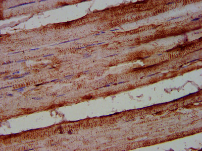 Immunofluorescence staining of A549 cells with CAC11434 at 1:166, counter-stained with DAPI. The cells were fixed in 4% formaldehyde, permeabilized using 0.2% Triton X-100 and blocked in 10% normal Goat Serum. The cells were then incubated with the antibody overnight at 4°C. The secondary antibody was Alexa Fluor 488-congugated AffiniPure Goat Anti-Rabbit IgG(H+L).