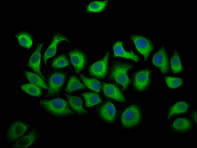 Alox12 Polyclonal Antibody - image 5