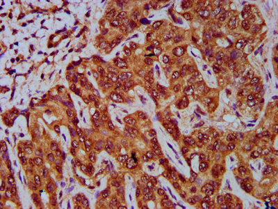 IHC image diluted at 1:400 and staining in paraffin-embedded human placenta tissue performed on a Leica BondTM system. After dewaxing and hydration, antigen retrieval was mediated by high pressure in a citrate buffer (pH 6.0). Section was blocked with 10% normal goat serum 30min at RT. Then primary antibody (1% BSA) was incubated at 4°C overnight. The primary is detected by a biotinylated secondary antibody and visualized using an HRP conjugated SP system.