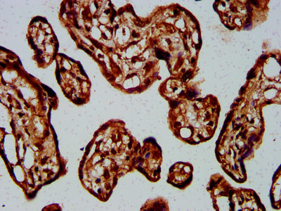 Immunofluorescence staining of Hela cells with CAC11439 at 1:133, counter-stained with DAPI. The cells were fixed in 4% formaldehyde, permeabilized using 0.2% Triton X-100 and blocked in 10% normal Goat Serum. The cells were then incubated with the antibody overnight at 4°C. The secondary antibody was Alexa Fluor 488-congugated AffiniPure Goat Anti-Rabbit IgG(H+L).