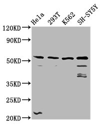 Immunofluorescence staining of Hela cells with CAC11456 at 1:133, counter-stained with DAPI. The cells were fixed in 4% formaldehyde, permeabilized using 0.2% Triton X-100 and blocked in 10% normal Goat Serum. The cells were then incubated with the antibody overnight at 4°C. The secondary antibody was Alexa Fluor 488-congugated AffiniPure Goat Anti-Rabbit IgG(H+L).