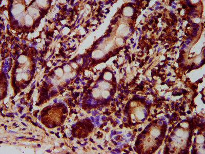 Gpt2 Polyclonal Antibody - image 3