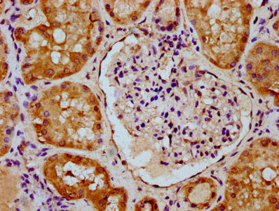 Immunofluorescence staining of HepG2 cells with CAC11472 at 1:100, counter-stained with DAPI. The cells were fixed in 4% formaldehyde, permeabilized using 0.2% Triton X-100 and blocked in 10% normal Goat Serum. The cells were then incubated with the antibody overnight at 4°C. The secondary antibody was Alexa Fluor 488-congugated AffiniPure Goat Anti-Rabbit IgG(H+L).