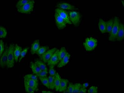 Cnnm2 Polyclonal Antibody - image 3