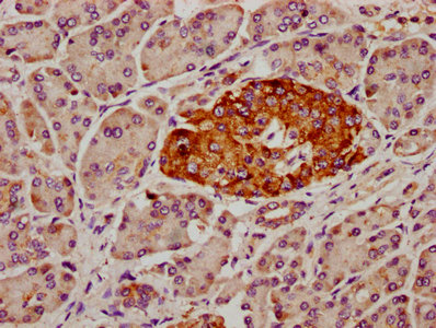 Immunofluorescence staining of A549 cells with CAC11476 at 1:100, counter-stained with DAPI. The cells were fixed in 4% formaldehyde, permeabilized using 0.2% Triton X-100 and blocked in 10% normal Goat Serum. The cells were then incubated with the antibody overnight at 4°C. The secondary antibody was Alexa Fluor 488-congugated AffiniPure Goat Anti-Rabbit IgG(H+L).