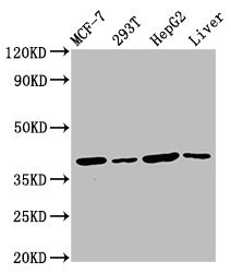 IHC image diluted at 1:400 and staining in paraffin-embedded human lymph node tissue performed on a Leica BondTM system. After dewaxing and hydration, antigen retrieval was mediated by high pressure in a citrate buffer (pH 6.0). Section was blocked with 10% normal goat serum 30min at RT. Then primary antibody (1% BSA) was incubated at 4°C overnight. The primary is detected by a biotinylated secondary antibody and visualized using an HRP conjugated SP system.