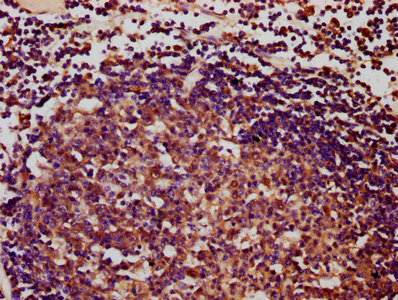 Iba57 Polyclonal Antibody - image 3