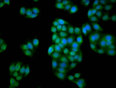 Iba57 Polyclonal Antibody - image 4