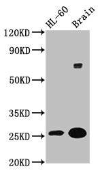 IHC image diluted at 1:300 and staining in paraffin-embedded human brain tissue performed on a Leica BondTM system. After dewaxing and hydration, antigen retrieval was mediated by high pressure in a citrate buffer (pH 6.0). Section was blocked with 10% normal goat serum 30min at RT. Then primary antibody (1% BSA) was incubated at 4°C overnight. The primary is detected by a biotinylated secondary antibody and visualized using an HRP conjugated SP system.