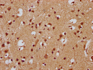 Fev Polyclonal Antibody - image 3