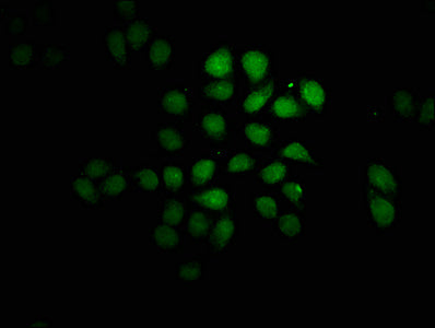 Fev Polyclonal Antibody - image 4