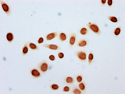 Acetyl-Hist1H2Bc (K11) Polyclonal Antibody - image 3