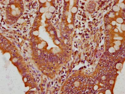 Cpne3 Polyclonal Antibody - image 3
