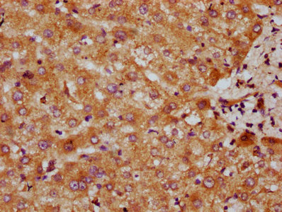 Cyp7A1 Polyclonal Antibody - image 3