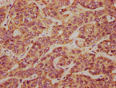 Tcaf2 Polyclonal Antibody - image 3