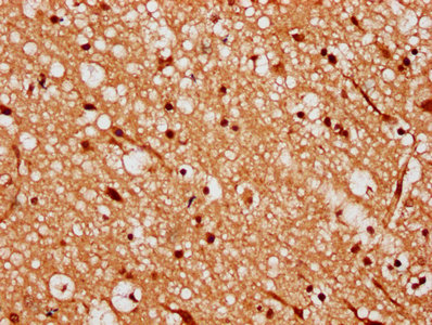Mex3A Polyclonal Antibody - image 3