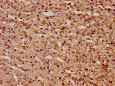 Kti12 Polyclonal Antibody - image 3