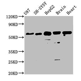 IHC image diluted at 1:300 and staining in paraffin-embedded human brain tissue performed on a Leica BondTM system. After dewaxing and hydration, antigen retrieval was mediated by high pressure in a citrate buffer (pH 6.0). Section was blocked with 10% normal goat serum 30min at RT. Then primary antibody (1% BSA) was incubated at 4°C overnight. The primary is detected by a biotinylated secondary antibody and visualized using an HRP conjugated SP system.