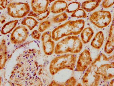 Bcl9 Polyclonal Antibody - image 3