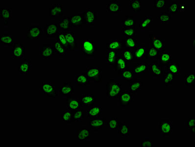 Bcl9 Polyclonal Antibody - image 4