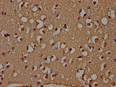 Adar Polyclonal Antibody - image 3