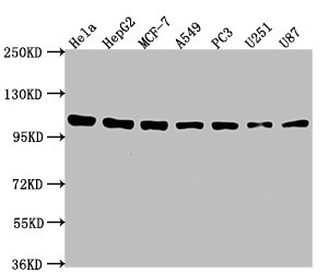 Immunofluorescence staining of Hela cells with CAC11647 at 1:133, counter-stained with DAPI. The cells were fixed in 4% formaldehyde, permeabilized using 0.2% Triton X-100 and blocked in 10% normal Goat Serum. The cells were then incubated with the antibody overnight at 4°C. The secondary antibody was Alexa Fluor 488-congugated AffiniPure Goat Anti-Rabbit IgG(H+L).