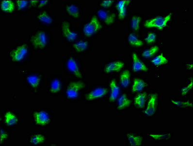 Actn1 Polyclonal Antibody - image 3