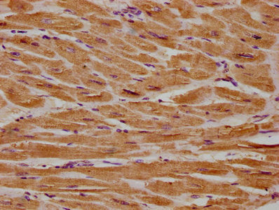 IHC image diluted at 1:300 and staining in paraffin-embedded human placenta tissue performed on a Leica BondTM system. After dewaxing and hydration, antigen retrieval was mediated by high pressure in a citrate buffer (pH 6.0). Section was blocked with 10% normal goat serum 30min at RT. Then primary antibody (1% BSA) was incubated at 4°C overnight. The primary is detected by a biotinylated secondary antibody and visualized using an HRP conjugated SP system.