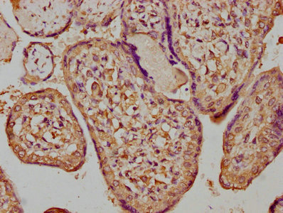 Csf3R Polyclonal Antibody - image 3