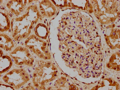 Pkn3 Polyclonal Antibody - image 3