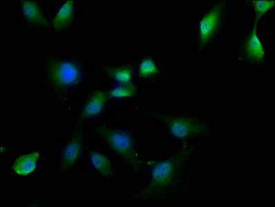 Otud3 Polyclonal Antibody - image 3