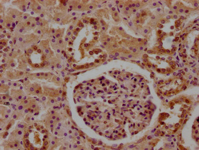 Cfhr5 Polyclonal Antibody - image 3