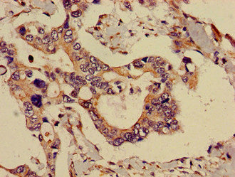 Immunofluorescent analysis of PC-3 cells using CAC11718 at dilution of 1:100 and Alexa Fluor 488-congugated AffiniPure Goat Anti-Rabbit IgG(H+L)