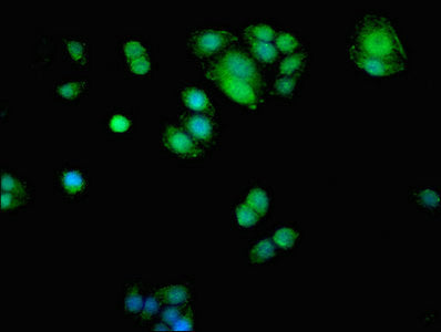 Adk Polyclonal Antibody - image 5