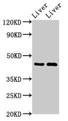 Immunohistochemistry analysis of human ovarian cancer using CAC11722 at dilution of 1:100