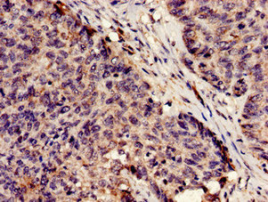 Immunofluorescent analysis of HepG2 cells using CAC11722 at dilution of 1:100 and Alexa Fluor 488-congugated AffiniPure Goat Anti-Rabbit IgG(H+L)
