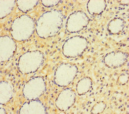 Immunohistochemistry of paraffin-embedded human pancreatic tissue using CAC11724 at dilution of 1:100